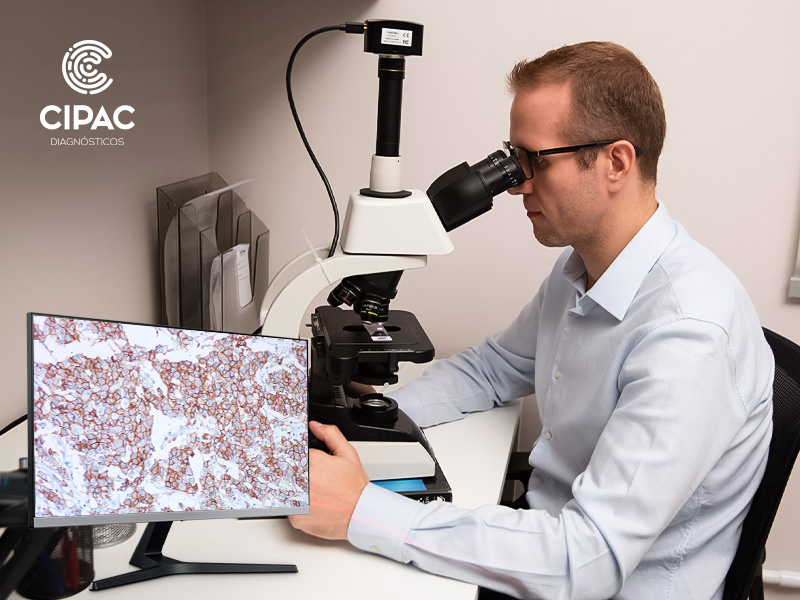 Como funciona a técnica de imunohistoquímica