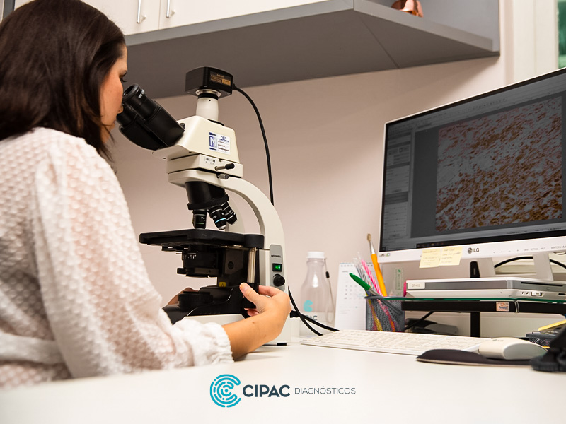 Imunohistoquímica em dermatopatologia: quando é utilizada?