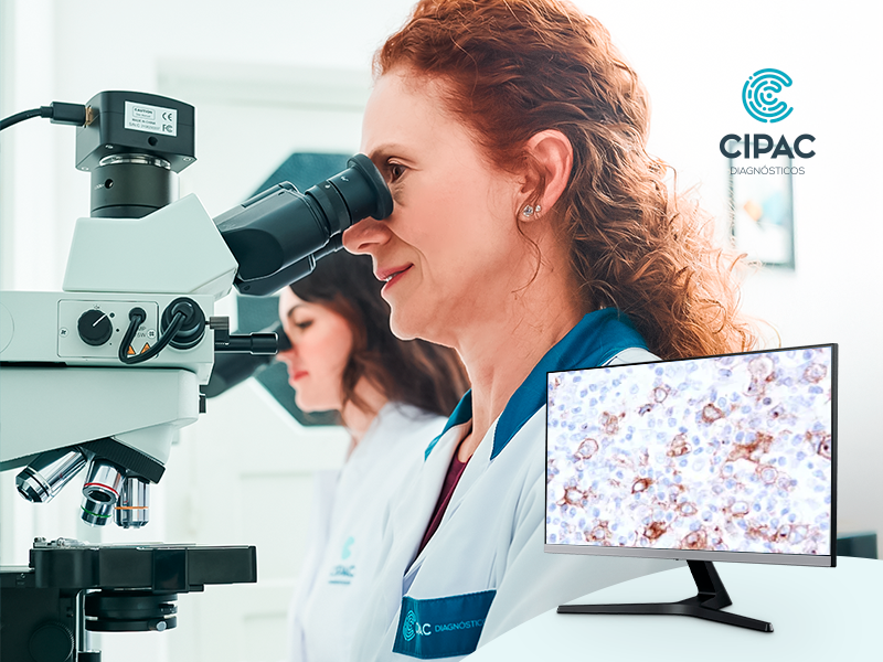 Uso da imunohistoquímica em tumores raros