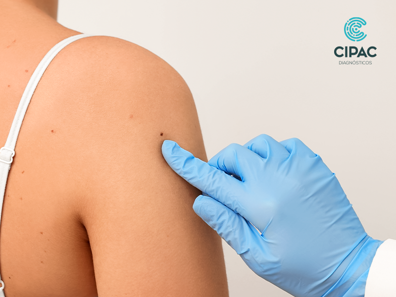 Biópsia da pele através da dermatopatologia
