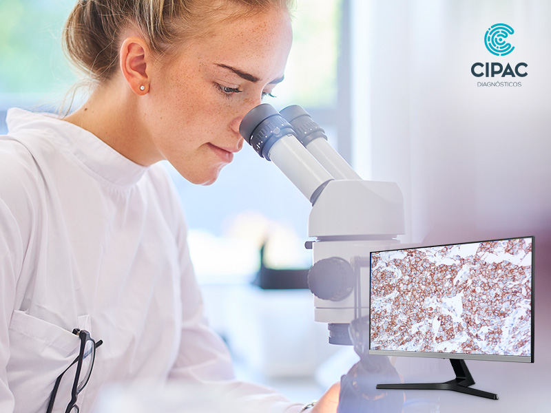 Imuno-histoquímica em medicina personalizada: do diagnóstico preciso à decisão terapêutica