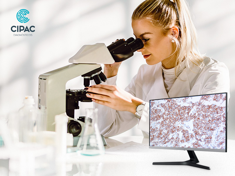 Imuno-histoquímica para doenças: aplicações além da oncologia